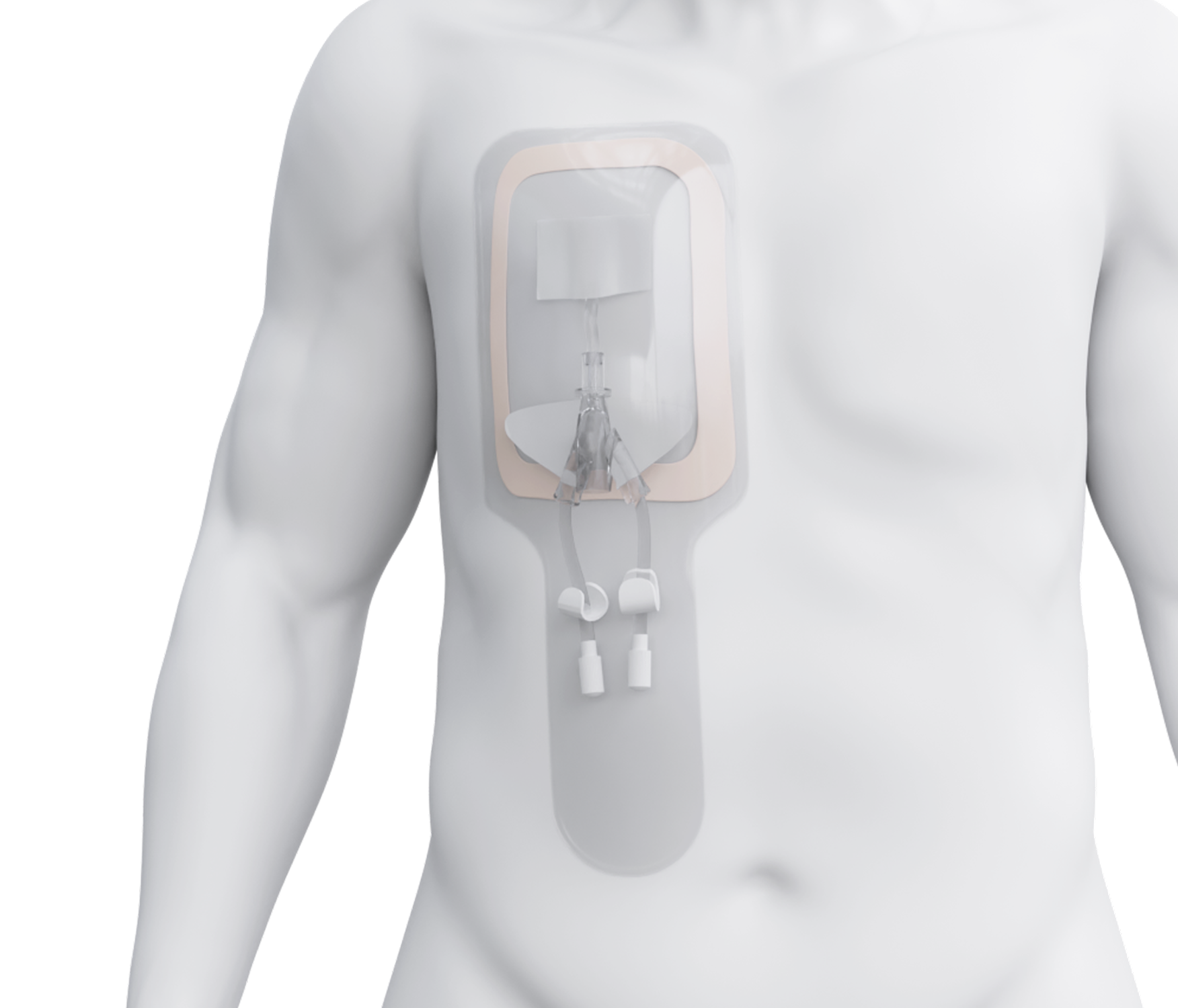 Product Dialtec™ Waterproof Protection Pouch image 1